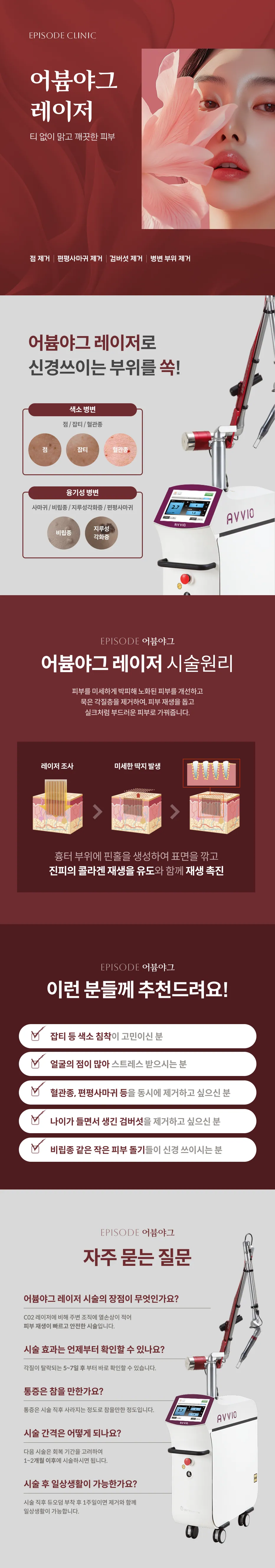 エルビウムレーザー詳細ガイド：ドット、扁平疣贅、剣キノコ、病変部位の除去、色素病変と隆起性病変の種類、施術原理、対象案内、よくある質問